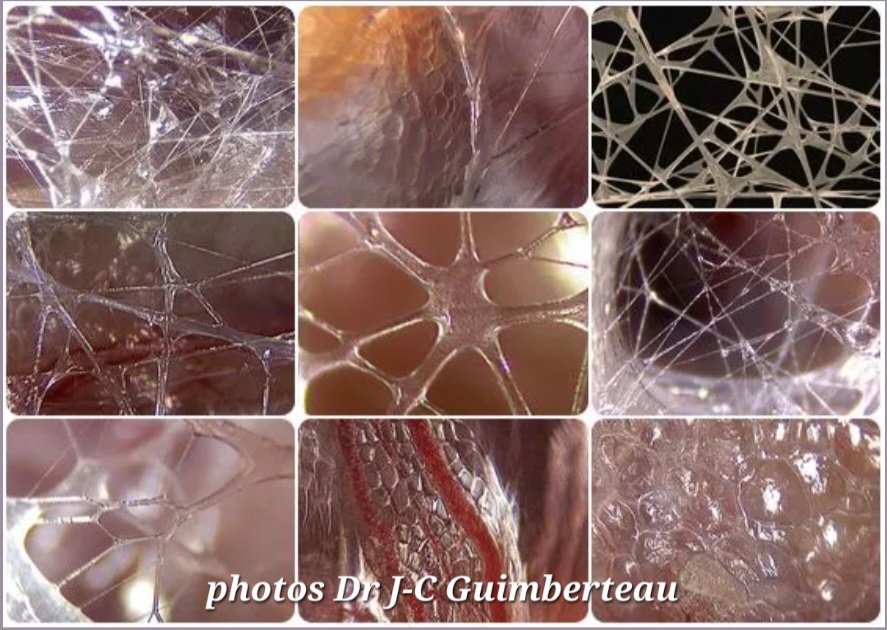 fascia